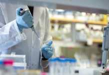 Coronavirus: 87 nuevos casos en el país y 12 muertes en total