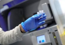 Argentina hará testeos rápidos para detectar asintomáticos y no se usarán en sospechosos