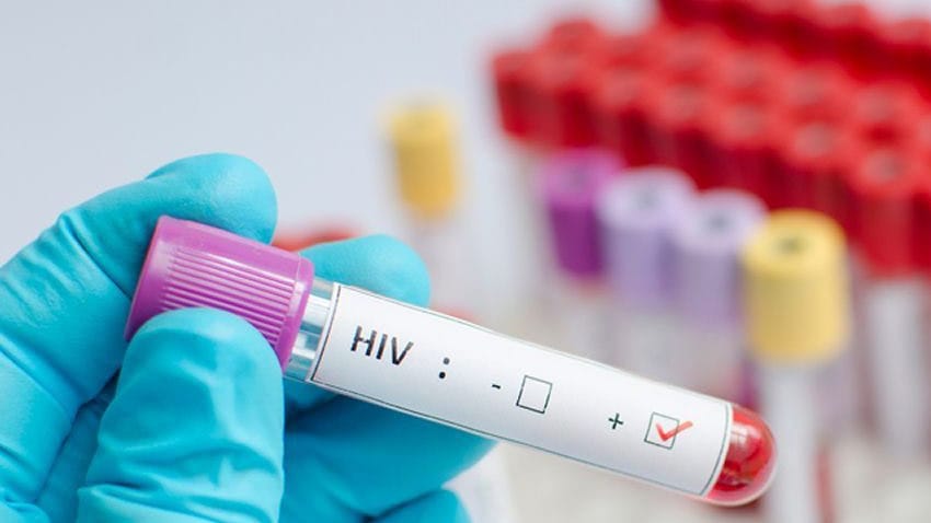 hiv