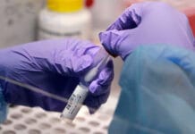 Por las trabas a las importaciones, advierten que faltarán reactivos para diagnosticar enfermedades