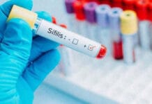 En 2025 Argentina registró más de 46.000 casos de sífilis
