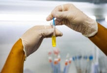 Santa Lucía realizará una jornada gratuita de prevención por el Día Mundial del Cáncer de Próstata