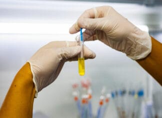 Santa Lucía realizará una jornada gratuita de prevención por el Día Mundial del Cáncer de Próstata